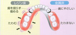ireba_pic02.gif