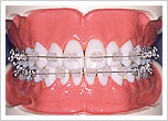 ortho_pic02.jpg